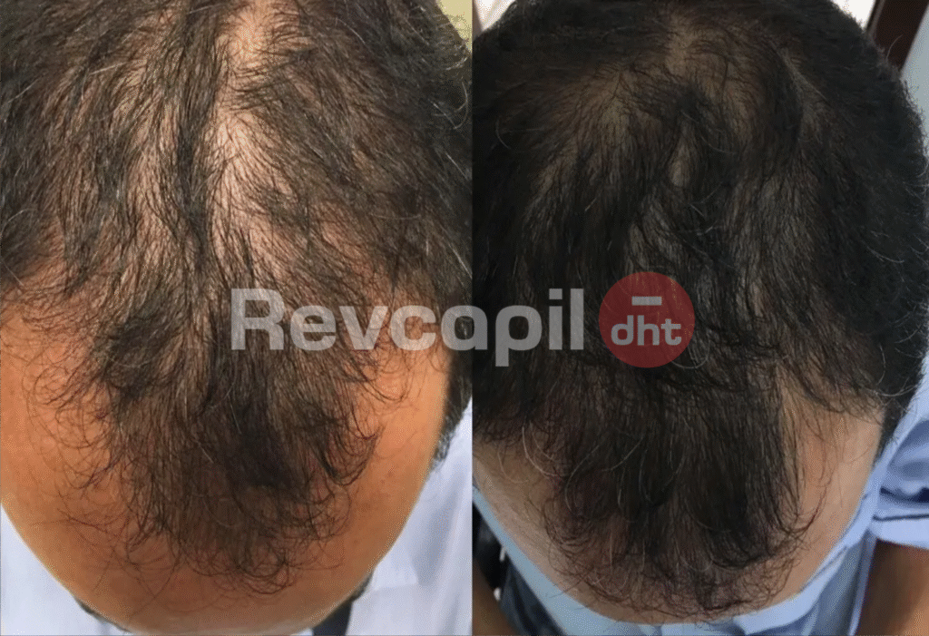 revcapil, revcapil dht cliente 6